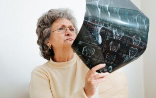 first-90-days-after-dementia-diagnosis