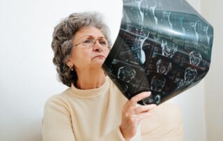 first-90-days-after-dementia-diagnosis